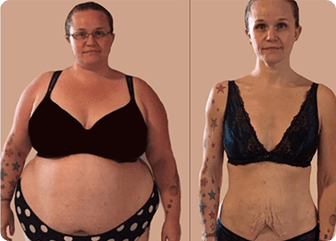 Customer before using ShapeON