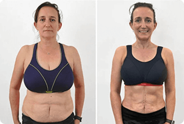 Customer before using ShapeON